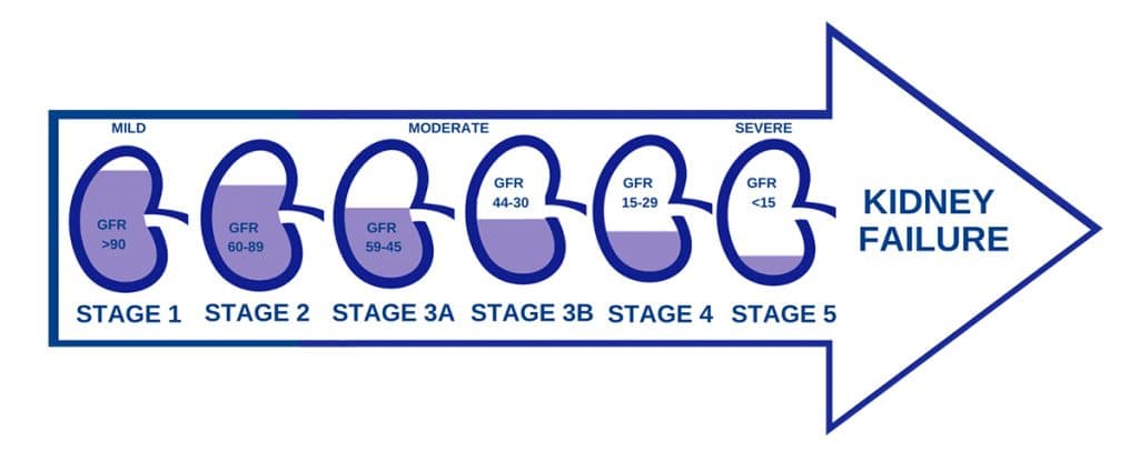 stages-of-kidney-disease-dallas-nephrology-associates