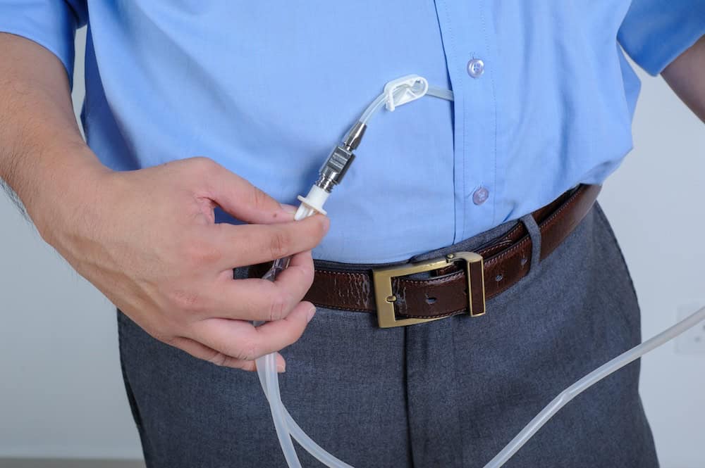 A person wearing a blue shirt and grey pants is using medical tubing around their abdomen, possibly for an insulin pump or another medical device related to early signs of kidney disease. Their hand is holding the tubing close to a connection point.